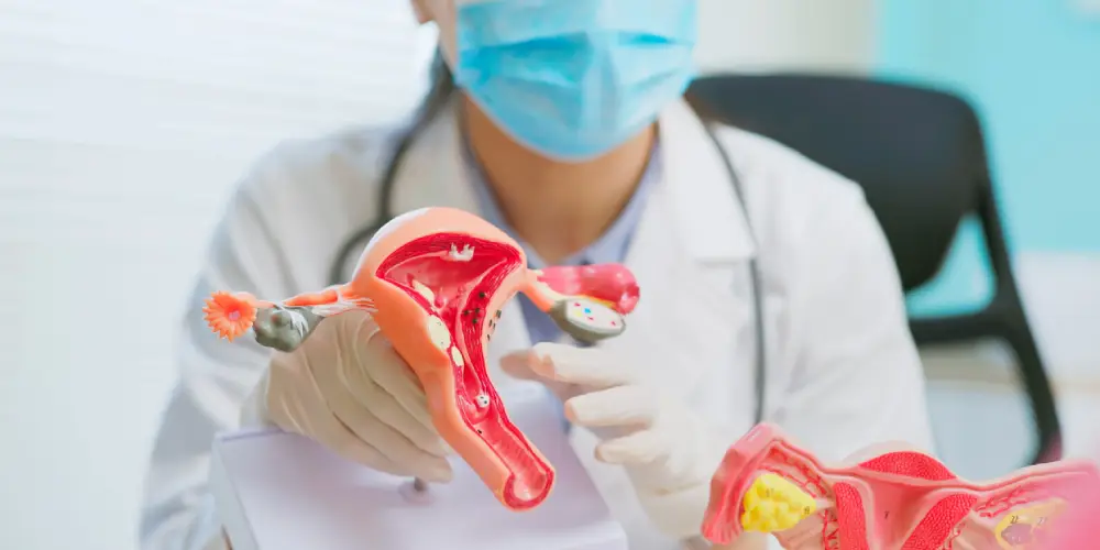 روش های درمان تنبلی تخمدان کدامند؟