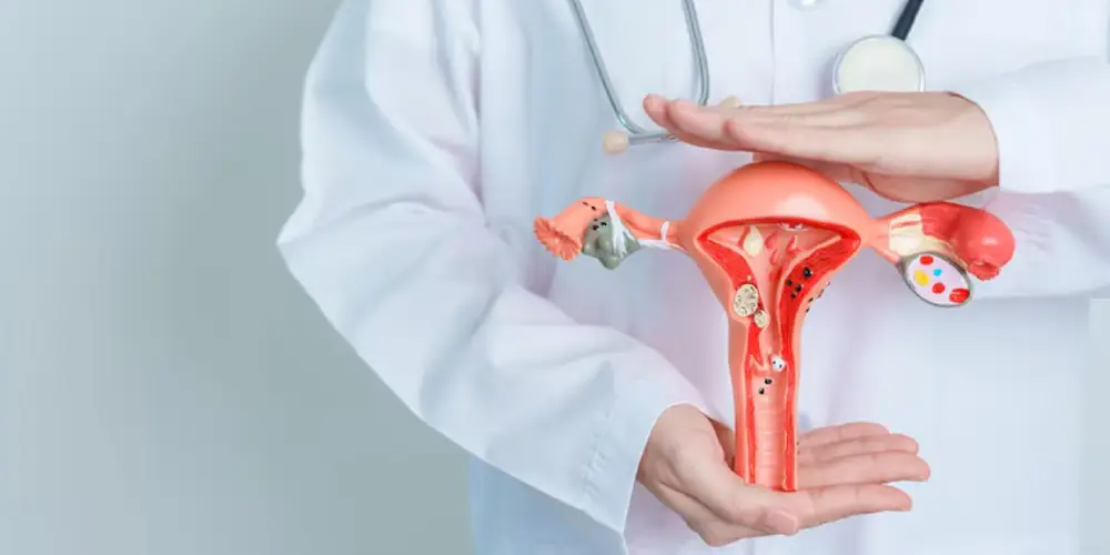 آشنایی با عوارض تنبلی تخمدان